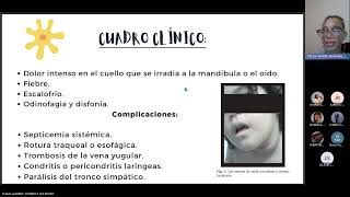 Semiologia quirurgica grupo c  Tiroiditis Diagnostico y manejo [upl. by Philly]