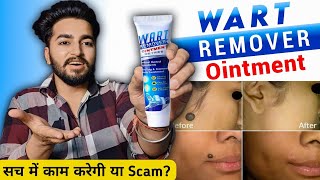 Wart Remover Cream Review  Wart Remover Ointment [upl. by Melac620]