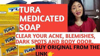 TURA MEDICATED SOAPTO CLEAR ACNE BODY ODOUR BLEMISHES DANDRUFF DARk SPOTUSE AS ANTIBACTERIAL [upl. by Patrizia]