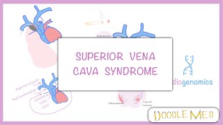 Approach to Treatment of Superior Vena Cava Syndrome [upl. by Martina913]