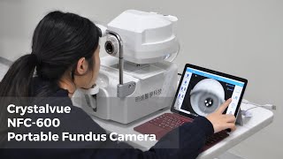 Crystalvue NFC600 Portable Fundus Camera｜Automatic NonMydriatic Retinal Camera ATM CameraTelemed [upl. by Dodge235]