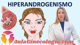 HIPERANDROGENISMO SOP ADRENAL HIPERPLASIA SUPRARRENAL CONGÉNITA  Ginecología y Obstetricia [upl. by Elimay]