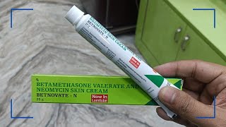 Betamethasone Valerate and Neomycin Skin Cream Uses In Hindi  Betnovate N Cream In Hindi [upl. by Aihtnis]