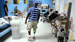 Haitian Amputee Walking on Below Knee Prosthetic Leg [upl. by Junna]