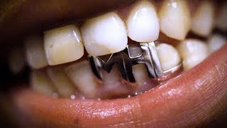 Grills jewellery for your teeth [upl. by Eilujna]