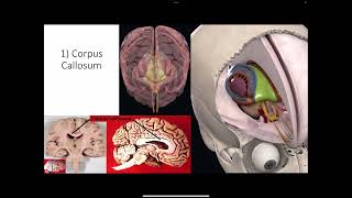 Neurology Intro to subcortical structures 2 [upl. by Tereve]