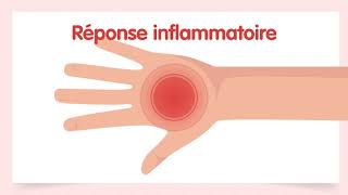 Quel est le lien entre le psoriasis et le rhumatisme psoriasique [upl. by Husha]