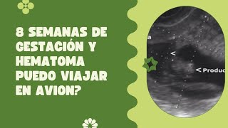 8 SEMANAS DE GESTACIÓN Y TENGO HEMATOMA PUEDO VIAJAR EN AVIÓN ✈️ [upl. by Yhtimit]