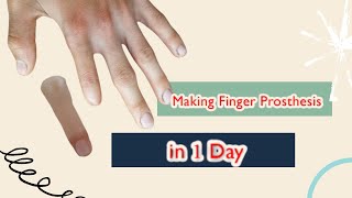 making Finger prosthesis  index finger lost  prosthesis  Custom finger prosthesis [upl. by Awram]