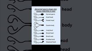 abnormal sperm shape  Human sperms [upl. by Wills]