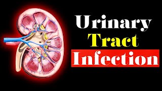 Urinary Tract Infection  Overview signs and symptoms pathophysiology causes and treatment [upl. by Josh]