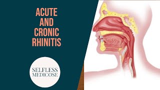 CHRONIC RHINITIS part 4 atrophic rhinitis continued important seq easy explanation [upl. by Pitzer]