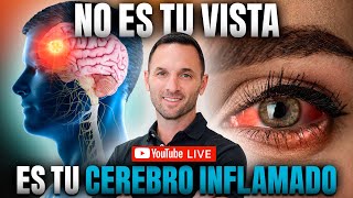 ¿Vista Borrosa Desinflama tu Cerebro en Lugar de Usar Anteojos [upl. by Eberto]