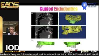 Uses of cbct in endodontics [upl. by Eisak]