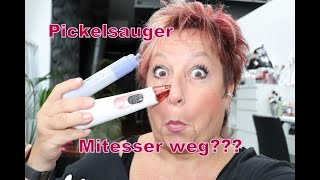 PickelPorensauger Test braucht man das wirklich Absaugen  Entfernung von Mitessern [upl. by Nosirrah539]