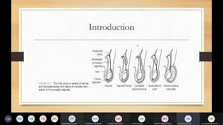 Pediatric Inguinoscrotal Disorders  Dr Ahmad Barakat [upl. by Fredkin]