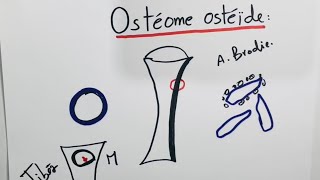 Orthopédie Tumeurs osseuses  Ostéome ostéoïde [upl. by Naji]