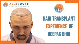 Patient Testimonial  Natural and LifeChanging Hair Transplant Results at Alloroots [upl. by Niccolo]