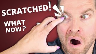 Scratched Eye  What You NEED To Know  Corneal Abrasion Symptoms Treatment [upl. by Astra]