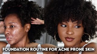 FLAWLESS FOUNDATION ROUTINE FOR ACNE PRONETEXTURED SKIN  KENSTHETIC [upl. by Ricardo]