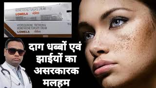 Ointment for melasma। Lomela ointment review Hydroquinone Tretinoin amp Mometasone cream। uses। [upl. by Francisca]