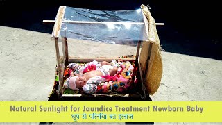 Dhoop Se Piliya Ka ilaj for New Born Baby Desi Jugad  Newborn Jaundice Treatment by Sunlight [upl. by Anaihs361]