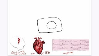 Refeeding Syndrome Explained USMLE [upl. by Scheers732]