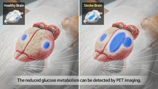 Diaschisis after stroke through astrocytic GABA [upl. by Shwalb]