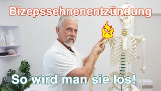 Bizepssehnenentzündung ⚡ So wird man sie los  Übungen und Tipps [upl. by Macnamara483]