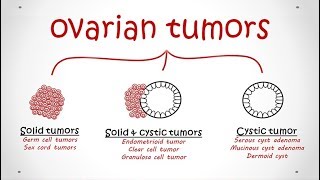 Ovarian Tumors All types Pathology [upl. by Joscelin991]