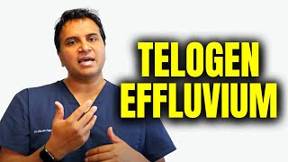 Telogen Effluvium Hair Loss [upl. by Seldan]