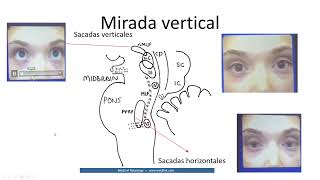 alteraciones de la mirada clase 3 Dr Luis Ernesto González Sánchez [upl. by Namlas]