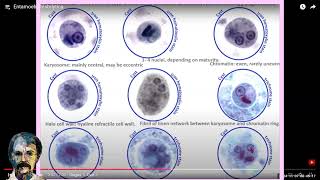 Diagnostic Parasitology Entamoeba histolyticaCourse [upl. by Areik]