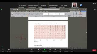 EKG  Clase 4  Bradiarritmias  Repaso del examen [upl. by Noffihc]