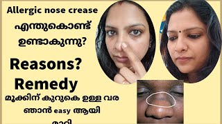 Allergic Nose CreaseHow to get rid of DARK LINE on NOSE മൂക്കിന് കുറുകെയുള്ള വര എങ്ങനെ മാറ്റാം [upl. by Coats723]