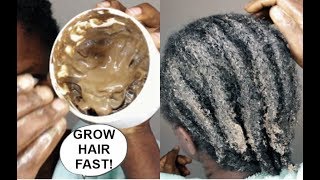 THIS CHANGED MY HAIR FROM 0 TO 100 GROW HAIR Long Thick amp Healthy FAST [upl. by Arraeis]