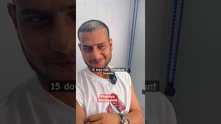 Youtuber Mehtab’s ka Hair Transplant hair hairtreatment shorts [upl. by Hastings921]