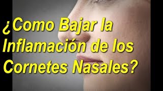 5 👀TRATAMIENTOS NATURALES para los 👃CORNETES de la NARIZ  Al 👉FINAL QUEDARAS 😲SORPRENDIDO [upl. by Eifos]