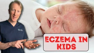 How to treat Eczema in Babies amp Children Dermatology Doctor explains [upl. by Ethelbert115]