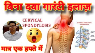 Cervical Spondylosis का सफलतम इलाज100 गारंटी के साथ [upl. by Annairt]