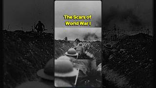 The Battle Scars of World War I history war military [upl. by Rogovy]