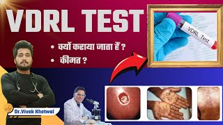 VDRL Test l VDRL Test In Hindi l Dr Vivek Khetwal vdrl youtube [upl. by Niamor]