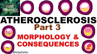 ATHEROSCLEROSIS Part 3  Morphology and consequences [upl. by Deering]