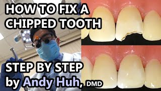 How to fix a chippedbroken tooth dental bonding composite Pasta Evergreen Dental Billerica MA [upl. by Lak731]