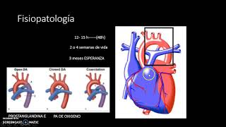 PERSISTENCIA DEL CONDUCTO ARTERIOSO PARTE 1 [upl. by Ecinaj329]