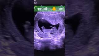 Level 2 ultrasound गर्भवती का महत्वपूर्ण अल्ट्रासाउंड [upl. by Esli]