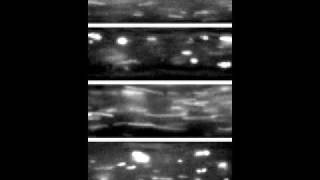 Axonal Organelle Transport in Motion [upl. by Aydidey]