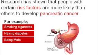 Pancreatic Cancer Prognosis [upl. by Anirres]