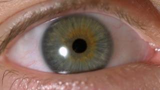 My Iris Wobbles  Eye In Slow Motion [upl. by Eseilana182]