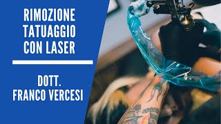 Rimuovere i tatuaggi con il laser a Picosecondi  Dott Franco Vercesi [upl. by Jennica]